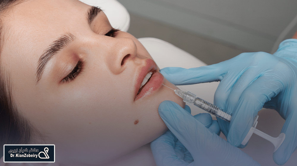 تزریق فیلر لب در کلینیک دکتر کیان زبیری
